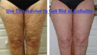 Title: Use This Advice To Get Rid Of Cellulite, Author: Christopher McNeil