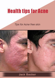 Title: Health tips for Acne, Author: Jack Backer