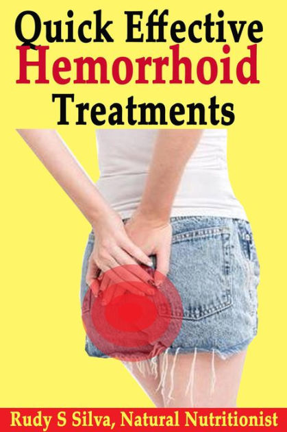 Quick Effective Hemorrhoid Treatments by Rudy Silva | NOOK Book (eBook ...