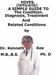 Title: Hives, (Urticaria) A Simple Guide To The Condition, Diagnosis, Treatment And Related Conditions, Author: Kenneth Kee