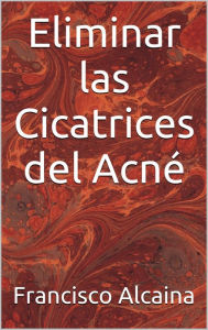 Title: Eliminar las Cicatrices del Acné, Author: Francisco Alcaina