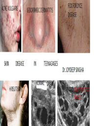 Title: Skin Diseases In Teenages., Author: Dr. Joydeep Singha