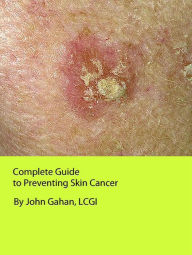 Title: Complete Guide to Preventing Skin Cancer, Author: John Gahan