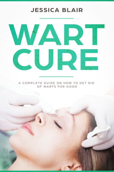 Wart Cure: A Complete Guide on How To Get Rid Of Warts For Good