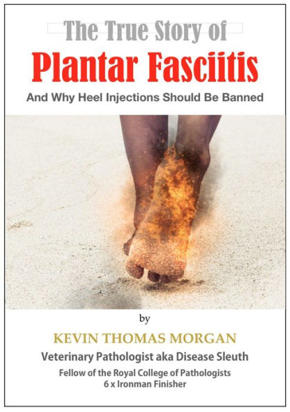 The True Story of Plantar Fasciitis: And Why Heel Injections Should Be Banned