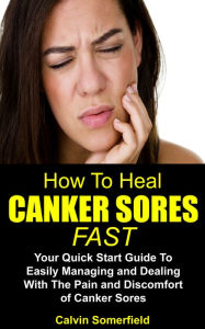 Title: How To Heal Canker Sores Fast: Your Quick Start Guide to Easily Managing and Dealing With the Pain and Discomfort of Canker Sores (Canker sore, canker sores, oral health), Author: Calvin Somerfield