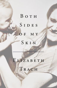 Title: Both Sides of My Skin, Author: Kim Joseph Michael's Group