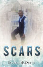 SCARS