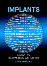 Title: Implants, Author: Daniel Marques