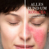 Alles Rund um Rosacea - Der kleine Ratgeber mit Tipps und Tricks