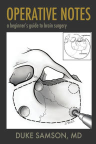 Title: Operative Notes: a beginner's guide to brain surgery, Author: Duke Samson