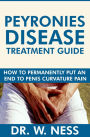 Peyronies Disease Treatment Guide