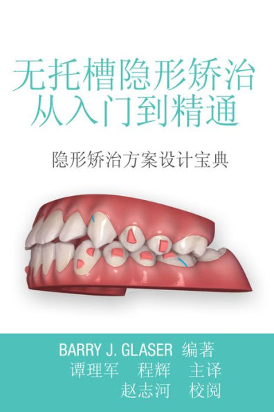 Insider's Guide to Invisalign Treatment (Chinese Edition)