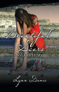 Title: Beautiful Scars, Author: Lynn Davis