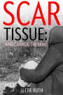 Scar Tissue: Who Can Heal The Pain?