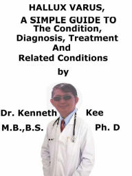 Title: Hallux Varus, A Simple Guide To The Condition, Diagnosis, Treatment And Related Conditions, Author: Kenneth Kee