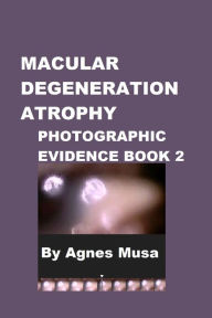 Title: Macular Degeneration Atrophy, Photographic Evidence Book 2, Author: Agnes Musa