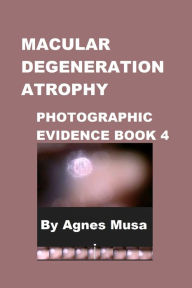 Title: Macular Degeneration Atrophy, Photographic Evidence Book 4, Author: Agnes Musa