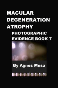 Title: Macular Degeneration Atrophy, Photographic Evidence Book 7, Author: Agnes Musa