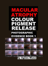 Title: Macular Atrophy Colour Pigment Release, Photographic Evidence Book 1, Author: Agnes Musa