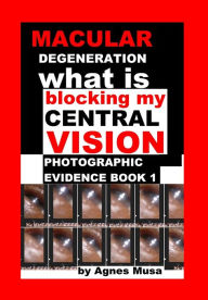 Title: Macular Degeneration, What Is Blocking My Central Vision, Photographic Evidence Book 1, Author: Agnes Musa