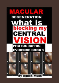 Title: Macular Degeneration, What Is Blocking My Central Vision, Photographic Evidence Book 2, Author: Agnes Musa