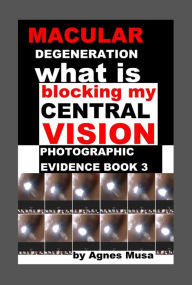 Title: Macular Degeneration, What Is Blocking My Central Vision, Photographic Evidence Book 3, Author: Agnes Musa