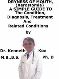 Title: Dryness of Mouth, (Xerostomia) A Simple Guide To The Condition, Diagnosis, Treatment And Related Conditions, Author: Kenneth Kee