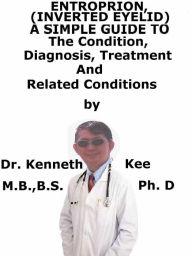 Title: Entropion, (Inverted Eyelid) A Simple Guide To The Condition, Diagnosis, Treatment And Related Conditions, Author: Kenneth Kee