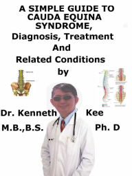 Title: A Simple Guide to Cauda Equina Syndrome, Diagnosis, Treatment and Related Conditions, Author: Kenneth Kee