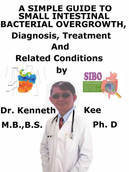 A Simple Guide to Small Intestinal Bacterial Overgrowth, Diagnosis, Treatment and Related Conditions