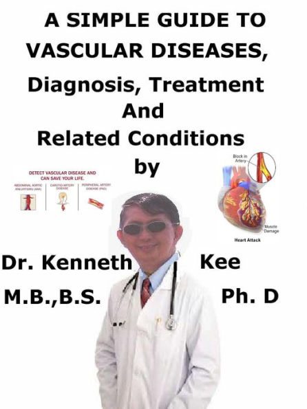 A Simple Guide to Vascular Diseases, Diagnosis, Treatment and Related Conditions