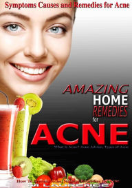 Title: Amazing Home Remedies for Acne, Symptoms Causes and Remedies For Acne, Author: M Laurence