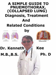 Title: A Simple Guide to Pneumothorax (Collapsed Lungs), Diagnosis, Treatment and Related Conditions, Author: Kenneth Kee