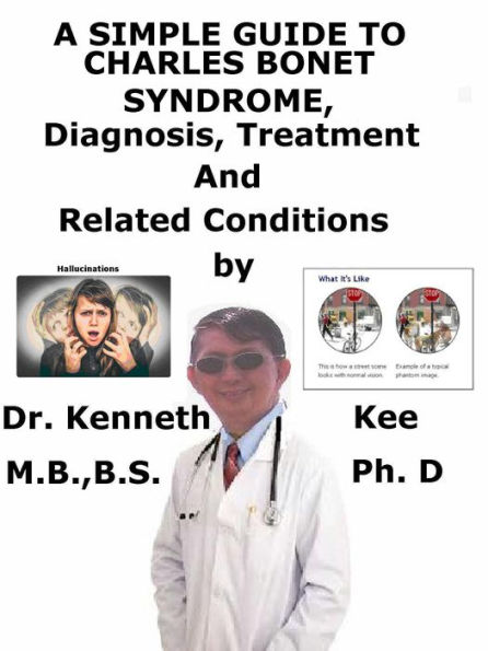 A Simple Guide to Charles Bonnet Syndrome, Diagnosis, Treatment and Related Conditions