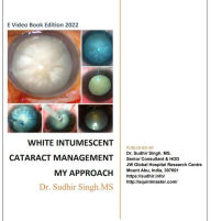 Title: White Intumescent Cataract Management: My Approach (2022, #1), Author: Sudhir Singh