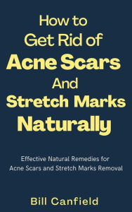 Title: How to Get Rid of Acne Scars and Stretch Marks Naturally, Author: Bill Canfield