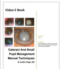 Title: Cataract And Small Pupil Management Manual Techniques (2022, #1), Author: Sudhir Singh