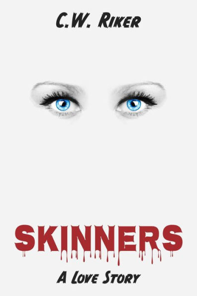 Skinners -- A Love Story