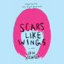 Scars Like Wings