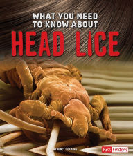 What You Need to Know about Head Lice