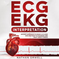 ECG/EKG Interpretation: An Easy Approach to Read a 12-Lead ECG and How to Diagnose and Treat Arrhythmias