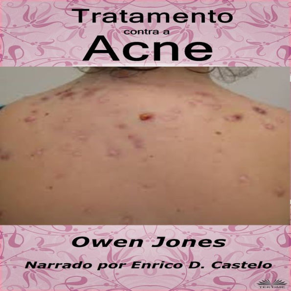 Tratamento contra a acne