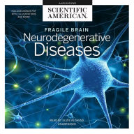 Fragile Brain: Neurodegenerative Diseases