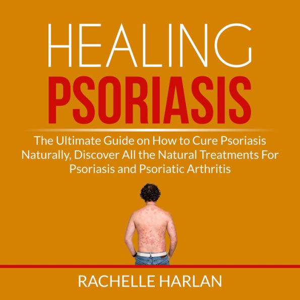 Healing Psoriasis: The Ultimate Guide on How to Cure Psoriasis Naturally, Discover All the Natural Treatments For Psoriasis and Psoriatic Arthritis