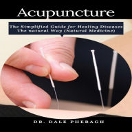 Acupuncture: The Simplified Guide for Healing Diseases The natural Way (Natural Medicine)