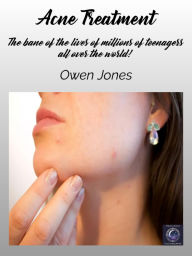 Title: Acne Treatment: The bane of the lives of millions of teenagers all over the world!, Author: Owen Jones