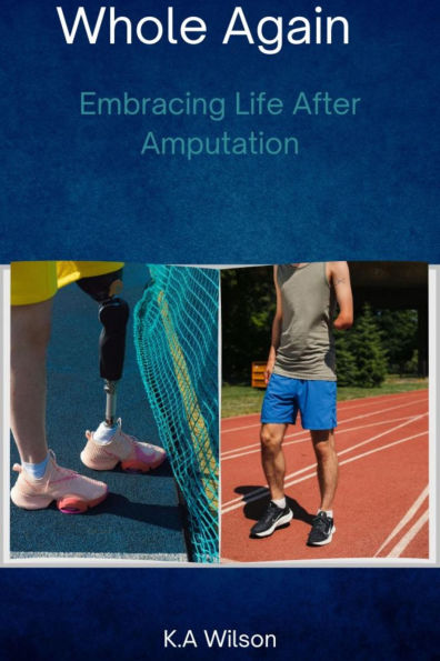 Whole Again: Embracing Life After Amputation