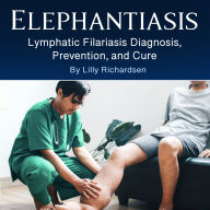 Elephantiasis: Lymphatic Filariasis Diagnosis, Prevention, and Cure