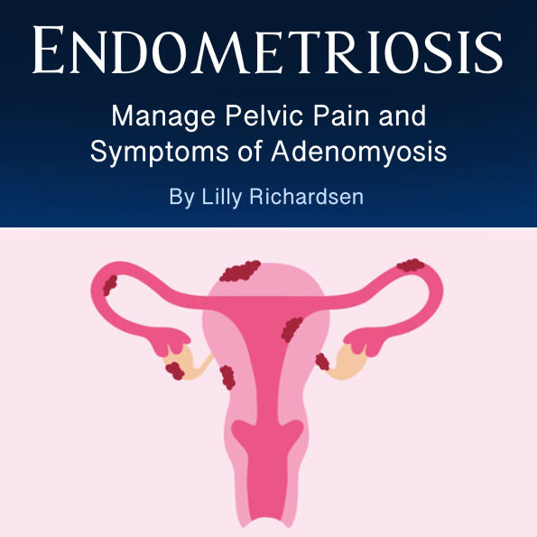 Endometriosis: Manage Pelvic Pain and Symptoms of Adenomyosis